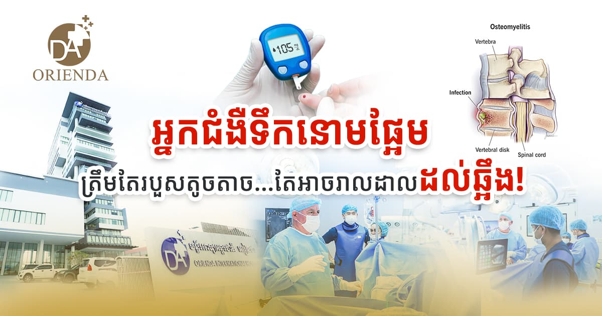 អ្នកជំងឺទឹកនោមផ្អែម ត្រឹមតែរបួសតូចតាច តែអាចរាលដាលដល់ឆ្អឹង !
